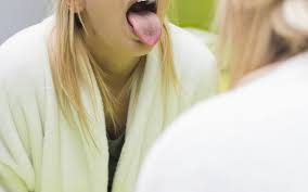 what causes tongue discolorations