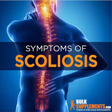 scoliosis symptoms causes treatment