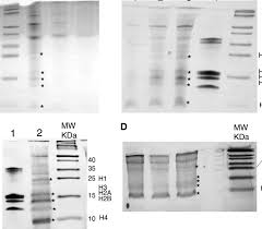 tris tricine sds page of histones