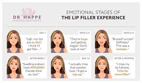 juvederm for lip injectionore