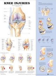 Knee Injuries Anatomical Chart Anatomical Chart Company
