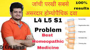 l4 l5 s1 disc bulge best homeopathic