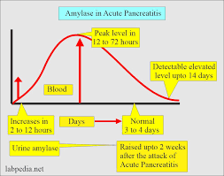 acute pancreais