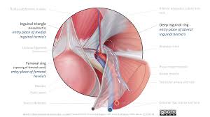 Our team curate various male anatomy groin. Leiden Drawing Entry Points Of Inguinal And Femoral Hernia S Internal View English Labels Anatomytool