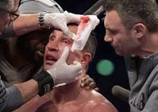 why-do-ufc-fighters-use-vaseline
