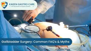 gallbladder surgery common faq s and