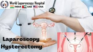 perform laparoscopic hysterectomy step