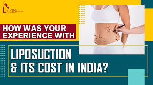 liposuction surgery cost in india