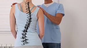 scoliosis to straighten spine