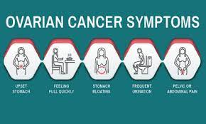 Ovarian cancer is sometimes referred to as a silent killer because early symptoms are often absent what often causes bloating in women with ovarian cancer in the later stages is ascites, which is a the fluid also makes the belly stick out more and that's why it looks like the pants don't fit anymore. 5 Early Symptoms Of Ovarian Cancer Ayaansh Hospital