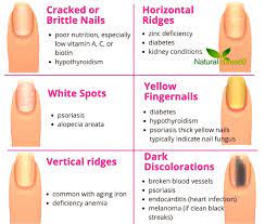 what do your nails say about your health