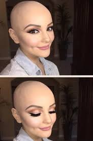 hair loss with a stunning photoshoot