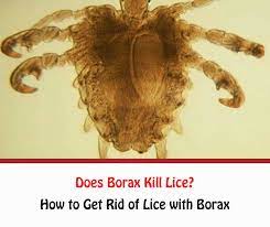 does borax kill lice