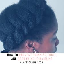 Follow these 6 tips to maintain a healthier hairline. How To Prevent Thinning Edges And Regrow Your Hairline Classycurlies Diy Clean Beauty And Healthy Living
