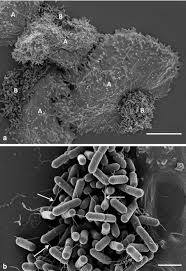 Listeria monocytogenes is the species of pathogenic bacteria that causes the infection listeriosis. Scanning Electron Microscopy Images Of Listeria Monocytogenes Download Scientific Diagram