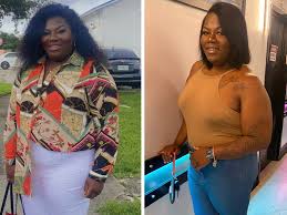weight loss surgery helps a miami woman