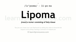 unciation of lipoma definition of