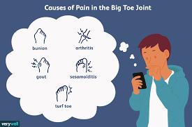 joint pain in the big toe 5 causes