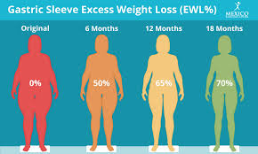 gastric sleeve excess weight loss ewl