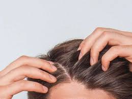 itchy scalp advanced dermatology of