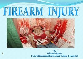 It was designed to penetrate light armor, such as on armored personnel carriers. Firearm Injuries