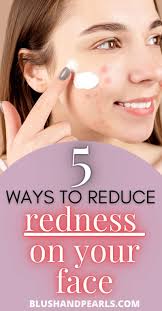 5 ways to manage redness
