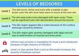 bed sores treatment ses and
