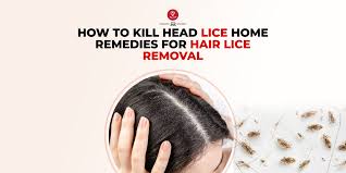 home remes for hair lice