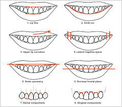 eight components of smile on orthodontics