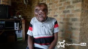 Stalking cat began to tattoo and surgically modify his face in the early the eighties, guided by his vision and his feelings of. Meet The World S Ugliest Man Who Is Married With 8 Children See Photos
