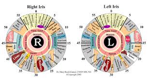 What Is Iridology Diagnosis Chart Iriscope Iridology