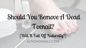 should you remove a dead toenail will