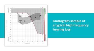 What Is High Frequency Hearing Loss