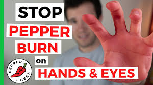 chili pepper burn on hands skin