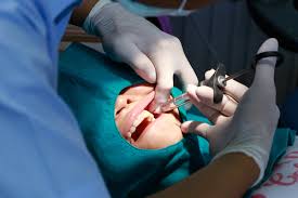 emergency dental extractions