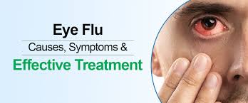 eye flu causes symptoms and