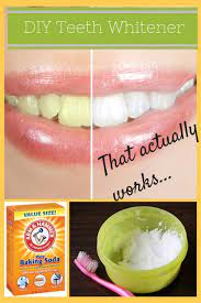 home teeth whitening for any budget