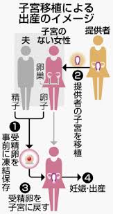 子宮移植 条件付き容認 日本医学会が報告書 | 沖縄タイムス＋プラス