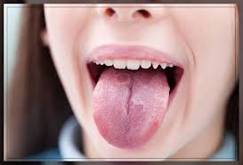 sore tongue causes treatment and