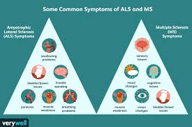 ms vs als similarities and differences