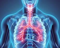 Image of Respiratory diseases
