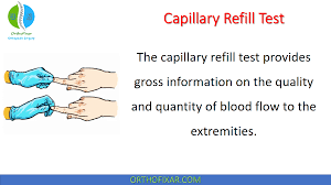 capillary refill test easy explained