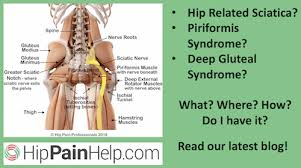 The quadratus lumborum muscle is known for sharp pain in the lower back and aching hip pain. Hip Related Sciatica Piriformis Syndrome And Deep Gluteal Syndrome What Is It What Are The Symptoms And What Causes It