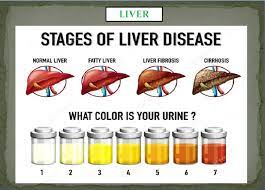 liver problems causes symptoms