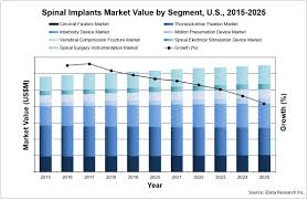 Spinal Implants Market Analysis Size Trends Global