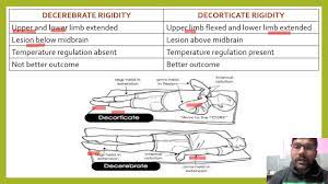 difference between decerebrate and