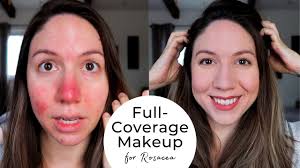 full coverage make up for rosacea it