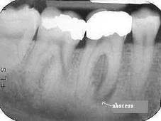  راديولوژي دندان