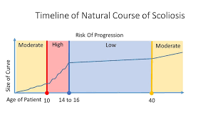 Timeline Of Natural Course Of Scoliosis Chiropractor In St