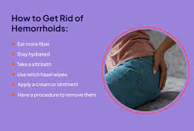hemorrhoids treatment options